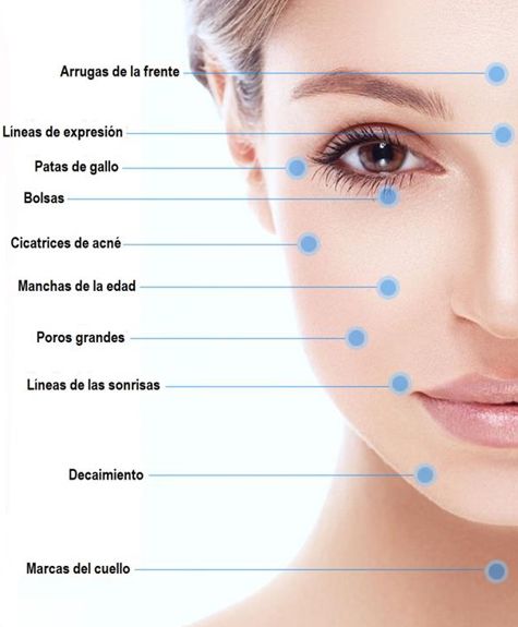 Dermapen rejuvenece y regenera tu piel